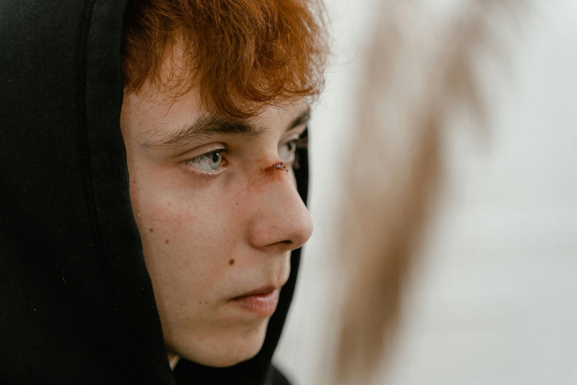 8 tips to reduce scars after surgery (image sourced via Pexels / Photo by mart)